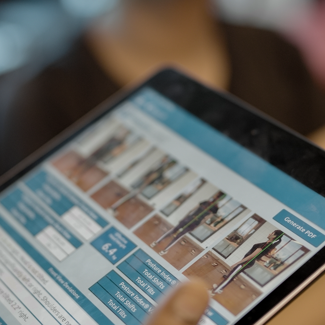 AIWO AI Powered Posture Screening Service