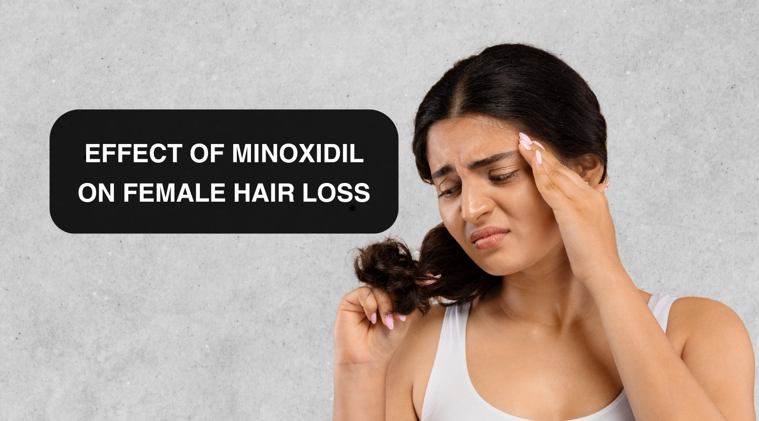 Minoxidil and female pattern baldness